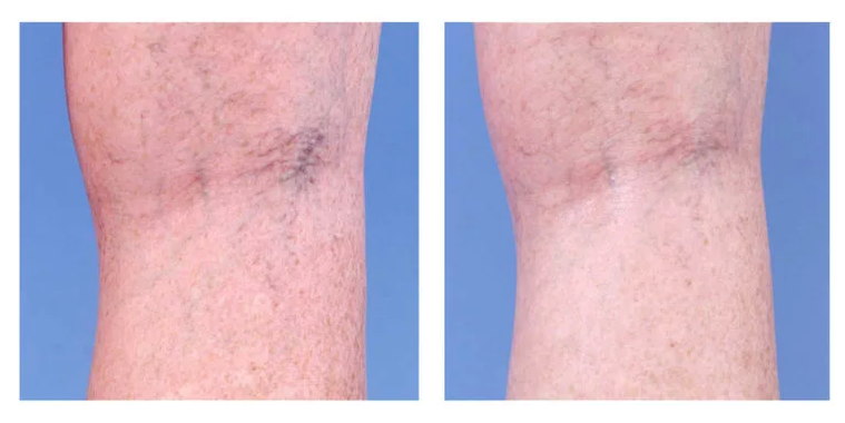 Correção cosmética